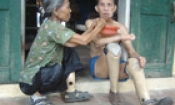Cái khó ở trại phong Quả Cảm