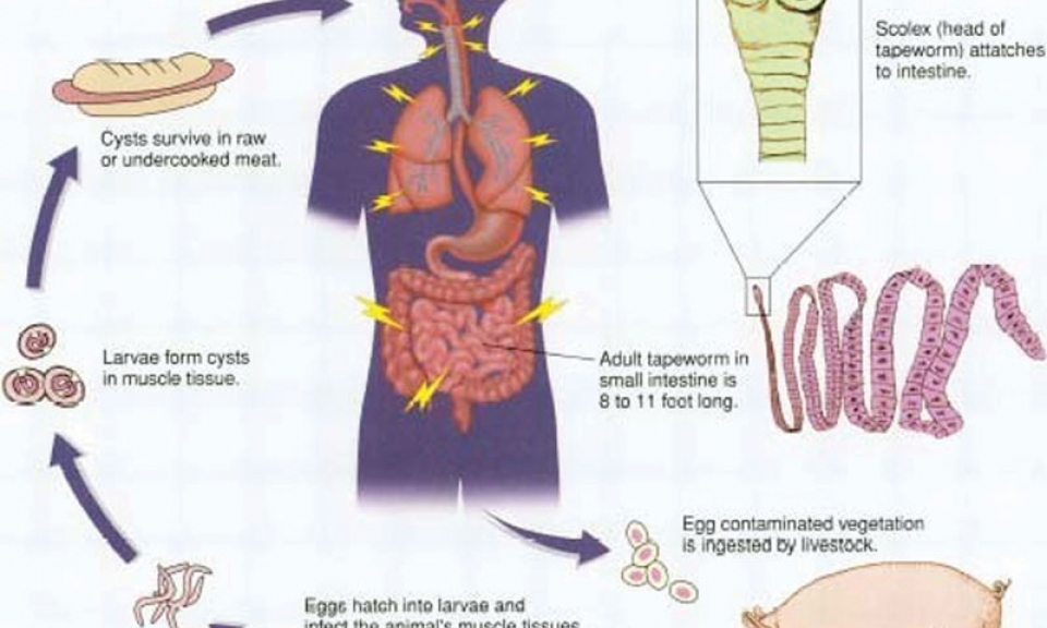 Bệnh sán dây, ấu trùng sán lợn và các biện pháp phòng bệnh