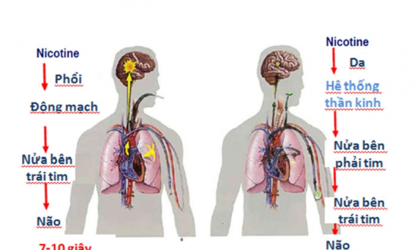 7 cách thuốc lá  hủy hoại não bộ của bạn