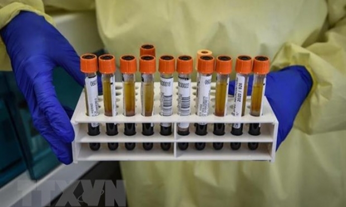 Italy thử nghiệm thành công kháng thể chống virus SARS-CoV-2