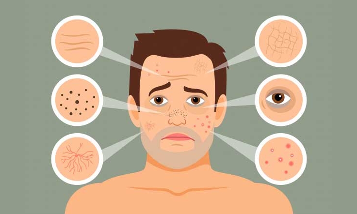 Làn da bị ảnh hưởng thế nào khi hút thuốc lá?