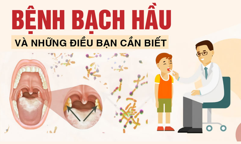 Bệnh bạch hầu và những điều cần biết