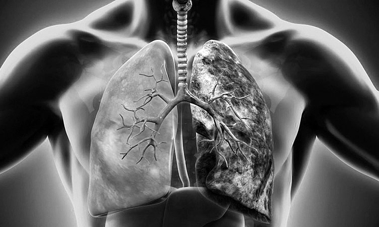 Tác hại của thuốc lá lên cơ thể