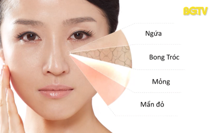 An to&agrave;n sống: Chăm s&oacute;c da nhạy cảm