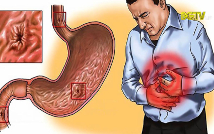 Cẩn trọng với bệnh xuất huyết ti&ecirc;u ho&aacute;