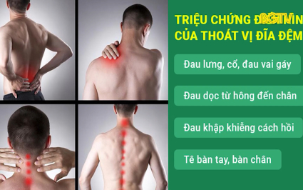 Lưu &yacute; trong ph&ograve;ng v&agrave; điều trị bệnh tho&aacute;t vị đĩa đệm