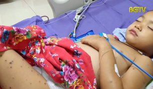 Sơn Động: Cảnh b&aacute;o nguy hiểm do ong đốt